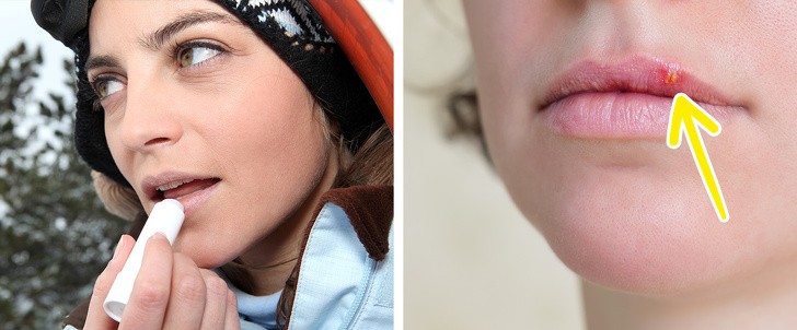 Ảnh: BrightSide. Ảnh: BrightSide.