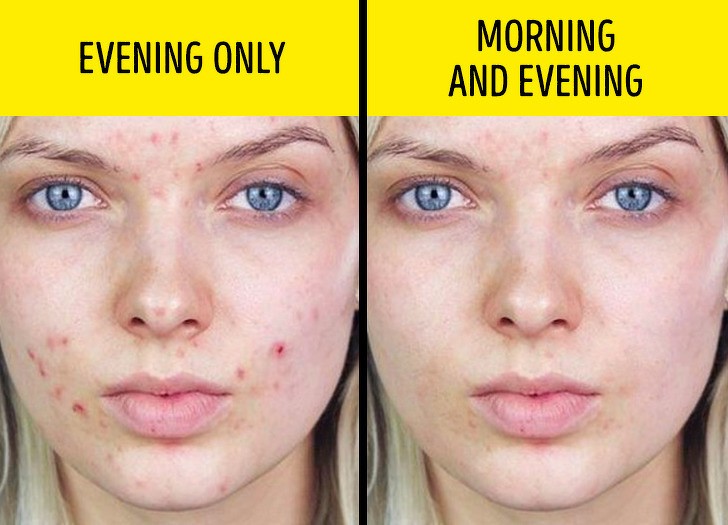 Ảnh: BrightSide Ảnh: BrightSide