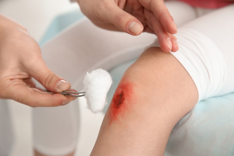 Cơ quan y tế Nhật Bản khuyến cáo người dân phải sát trùng vết thương hở và đeo khẩu trang để tránh lây nhiễm STSS (Ảnh: AP). Can sat trung vet thuong ho.jpg
