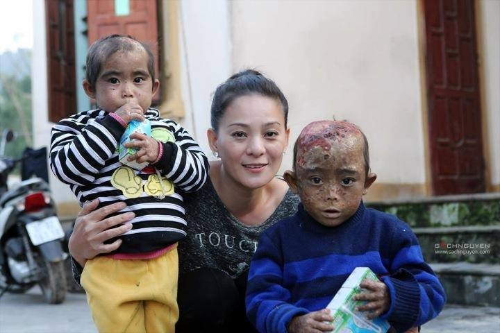 ĐS Huynh Trang Nhi tới thăm và tặng quà cho 2 em mắc bệnh hiểm nghèo tại Nghi Lộc (ảnh Hội CĐV SLNA)