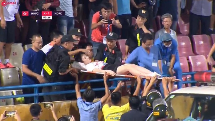 Hà Nội – Nam Định (6-1): mưa bàn thắng và pháo sáng khiến một cổ động viên phải cấp cứu ảnh 3 Máu đã đổ. Ảnh HNFC.