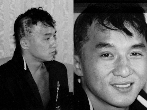 Nam diễn viên công bố hình ảnh sau khi phải phẫu thuật sọ não vì tai nạn trên trường quay phim "Áo giáp thượng đế" vào năm 1986. Trên đầu nam diễn viên hiện vẫn còn một vết lõm, tai còn di chứng, nghe âm cao là thấy đau nhói. Từ đó cho đến khi đóng phim "Câu chuyện cảnh sát năm 2013", anh mới cắt tóc ngắn trở lại. Nam diễn viên công bố hình ảnh sau khi phải phẫu thuật sọ não vì tai nạn trên trường quay phim "Áo giáp thượng đế" vào năm 1986. Trên đầu nam diễn viên hiện vẫn còn một vết lõm, tai còn di chứng, nghe âm cao là thấy đau nhói. Từ đó cho đến khi đóng phim "Câu chuyện cảnh sát năm 2013", anh mới cắt tóc ngắn trở lại.