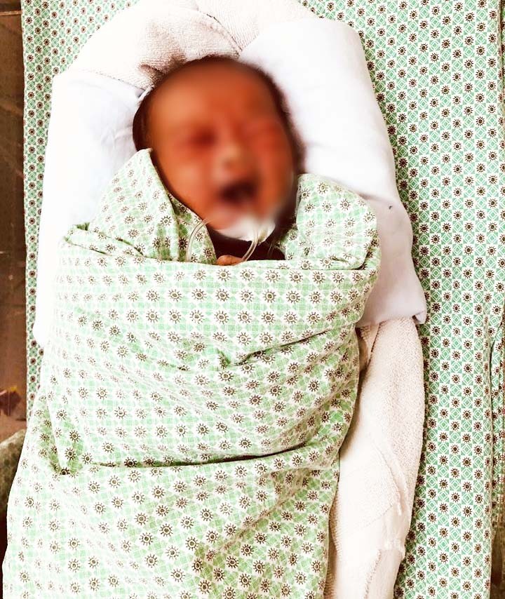 Bé sơ sinh 3 ngày tuổi bị bỏ rơi ở hố ga nhập viện trong tình trạng bị tổn thương khắp người. Ảnh: Kim Oanh