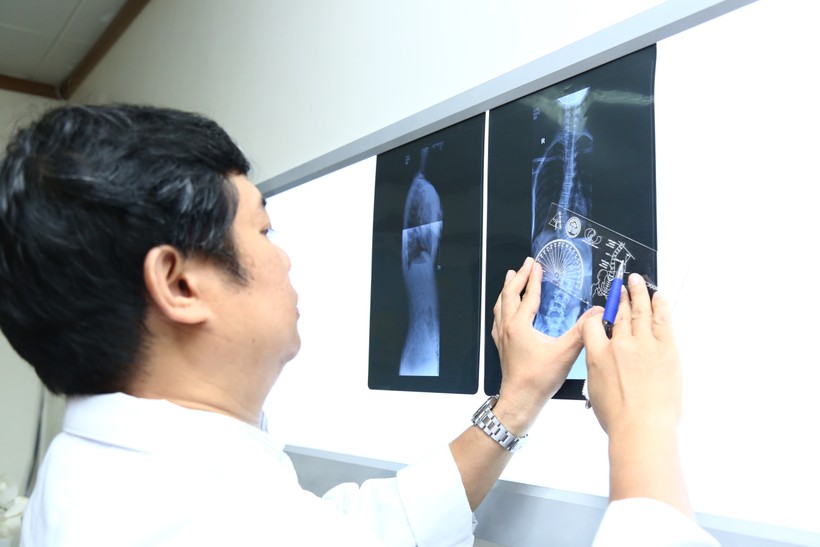 Bác sĩ xem phim chụp X-quang của bệnh nhân (Ảnh: BVCC) Bác sĩ xem phim chụp X-quang của bệnh nhân (Ảnh: BVCC)