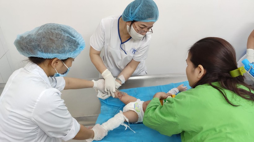 Bác sĩ chăm sóc cho bé bị bỏng nước sôi (Ảnh: Bệnh viện Đa khoa Xanh Pôn)