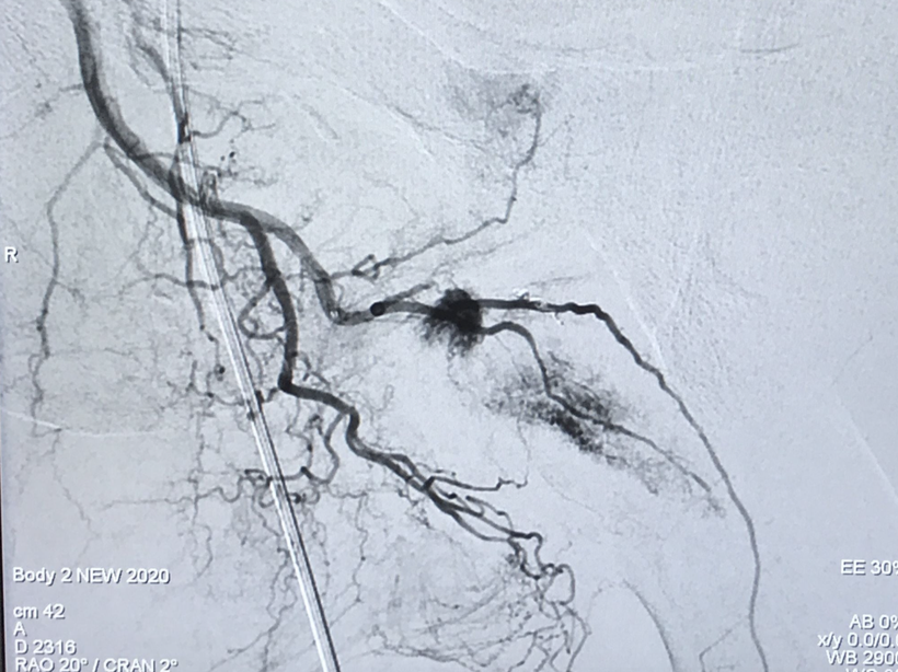 Ảnh chụp tình trạng của bệnh nhân (Ảnh - BVCC)