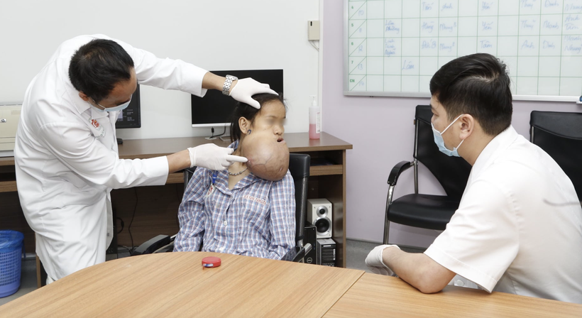 Các bác sĩ khám, xác định khối u cần phẫu thuật của bệnh nhân (Ảnh - BVCC)