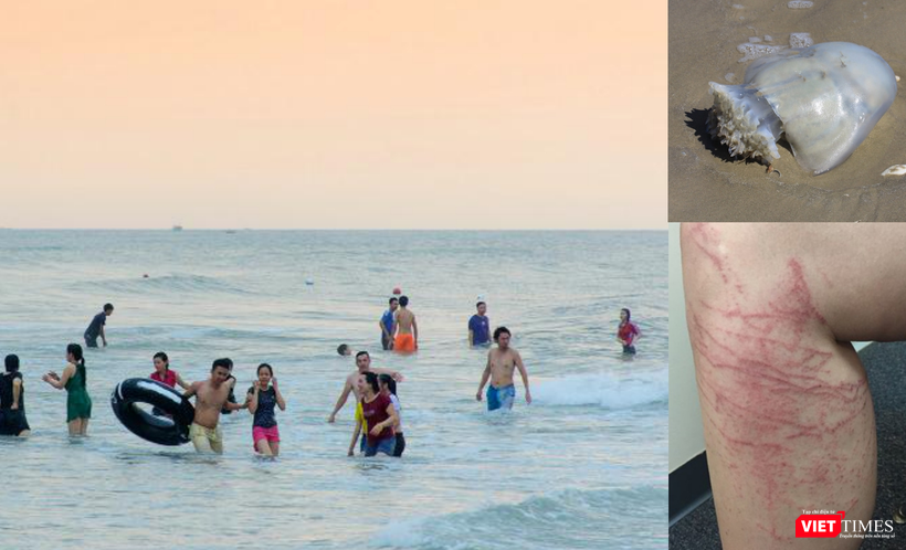 Nắng nóng đi tắm biển, cảnh giác kẻo bị sứa “tấn công”