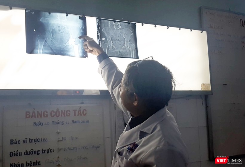 Bác sĩ Tăng Hà Nam Anh – Khoa Chấn thương Chỉnh hình (BV Nguyễn Tri Phương TP.HCM) chia sẻ về kỹ thuật thay khớp háng SuperPath và thay khớp gối Medial Pivot. Ảnh: NT Bác sĩ Tăng Hà Nam Anh – Khoa Chấn thương Chỉnh hình (BV Nguyễn Tri Phương TP.HCM) chia sẻ về kỹ thuật thay khớp háng SuperPath và thay khớp gối Medial Pivot. Ảnh: NT