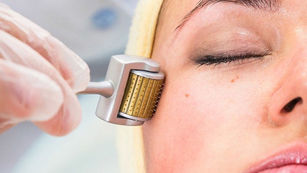 Lăn kim tại spa, một phụ nữ bị phù nề da mặt, mưng mủ